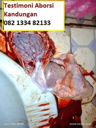 Jual Pil cytotec Asli ® WA.082133482133 Obat Aborsi Riau