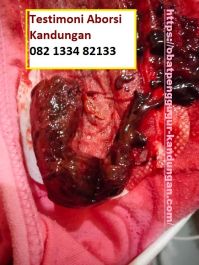 Obat Penggugur Kandungan ® WA.082133482133 Asli BITUNG