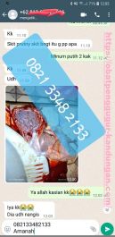 Obat Penggugur Kandungan ® WA.082133482133 Asli RIAU