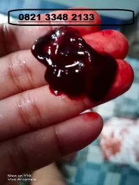 Obat Penggugur Kandungan ® WA.082213000040 OBAT CYTOTEC ASLI MANJUR