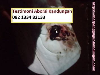 Obat Penggugur Kandungan ® WA.082133482133 Asli KALIMATAN