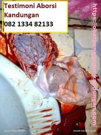 Obat Penggugur Kandungan ® WA.082133482133 Asli GASTRUL